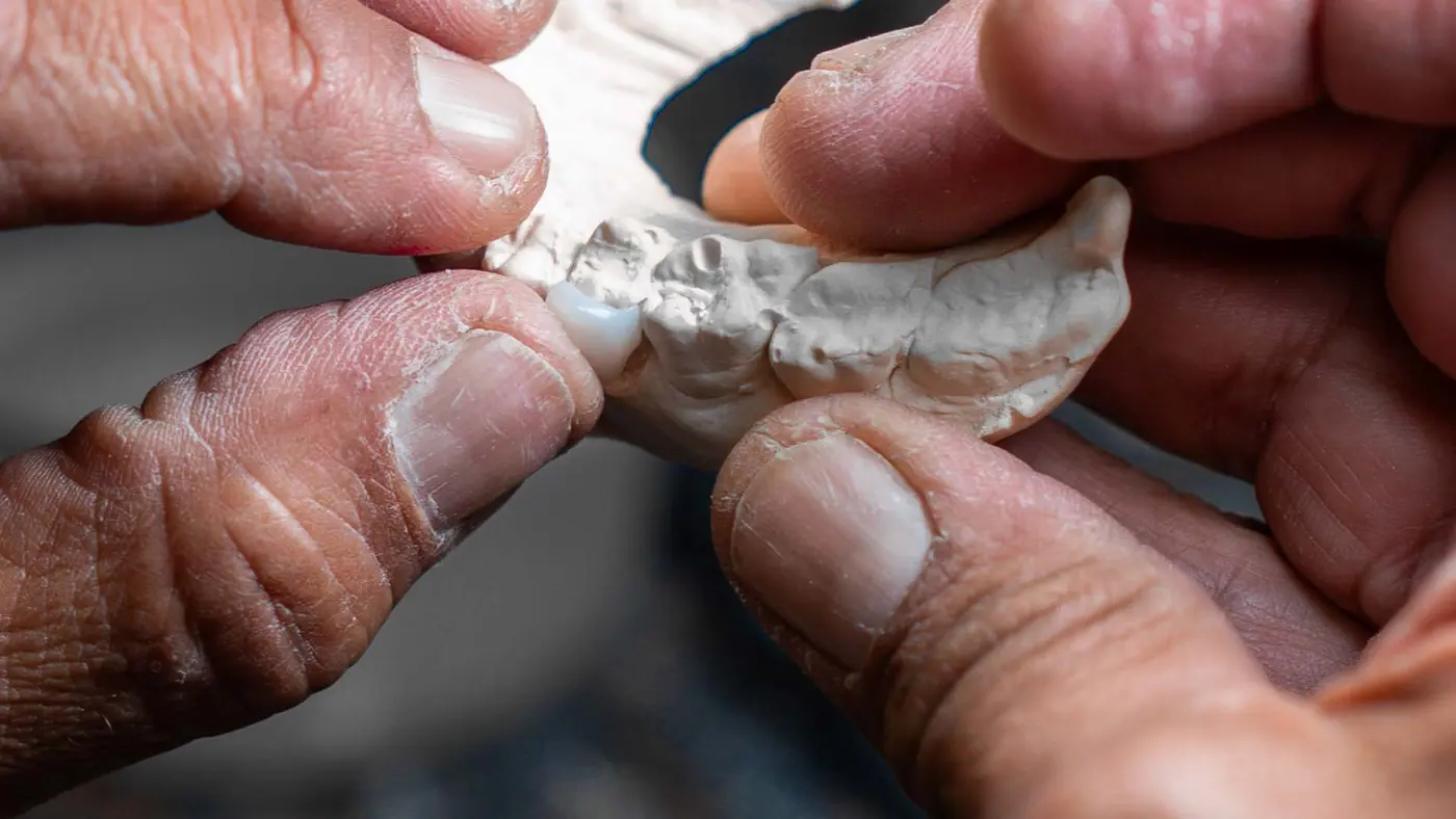 Dental laboratory technician hand-finishing a restoration on a stone model.
